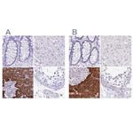 ERP27 Antibody in Immunohistochemistry (IHC)