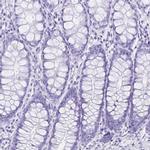 ERP27 Antibody in Immunohistochemistry (IHC)