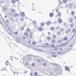 ERP27 Antibody in Immunohistochemistry (IHC)