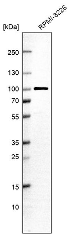 VPS51 Antibody in Western Blot (WB)