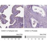 CASC1 Polyclonal Antibody