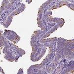 CASC1 Antibody in Immunohistochemistry (IHC)