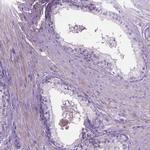 CASC1 Antibody in Immunohistochemistry (IHC)