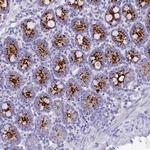 C12orf29 Antibody in Immunohistochemistry (Paraffin) (IHC (P))