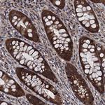 KIAA0701 Polyclonal Antibody