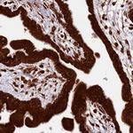 LARP4 Antibody in Immunohistochemistry (Paraffin) (IHC (P))