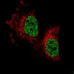 PARPBP Antibody in Immunocytochemistry (ICC/IF)