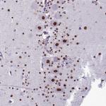 PARPBP Antibody in Immunohistochemistry (Paraffin) (IHC (P))