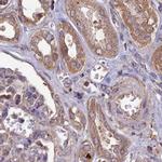 RCCD1 Antibody in Immunohistochemistry (IHC)