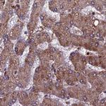 RCCD1 Antibody in Immunohistochemistry (IHC)