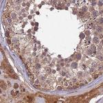 RCCD1 Antibody in Immunohistochemistry (IHC)