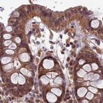 RCCD1 Antibody in Immunohistochemistry (IHC)