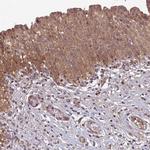 RCCD1 Antibody in Immunohistochemistry (IHC)