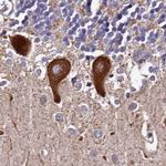 SPRYD3 Antibody in Immunohistochemistry (IHC)