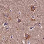 SPRYD3 Antibody in Immunohistochemistry (IHC)