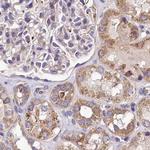 SPRYD3 Antibody in Immunohistochemistry (IHC)