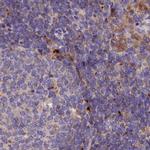 SPRYD3 Antibody in Immunohistochemistry (IHC)