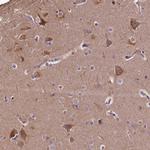 SPRYD3 Polyclonal Antibody