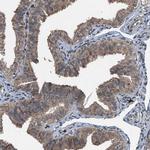 TCTN1 Antibody in Immunohistochemistry (IHC)