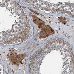 TCTN1 Antibody in Immunohistochemistry (IHC)