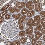 TCTN1 Antibody in Immunohistochemistry (IHC)