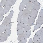 TCTN1 Polyclonal Antibody