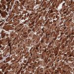 DIP13B Polyclonal Antibody