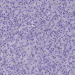 ADH7 Antibody in Immunohistochemistry (IHC)