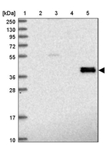 ADH7 Antibody in Western Blot (WB)