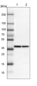 ADH7 Antibody in Western Blot (WB)