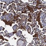DNHD1 Polyclonal Antibody
