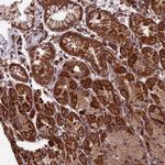 RNF17 Antibody in Immunohistochemistry (Paraffin) (IHC (P))