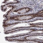 ESD Antibody in Immunohistochemistry (Paraffin) (IHC (P))