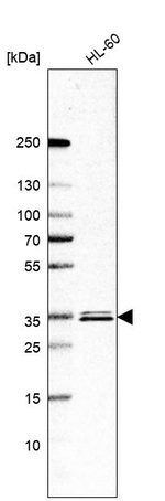 ESD Antibody in Western Blot (WB)