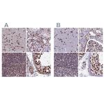 MPP8 Antibody in Immunohistochemistry (IHC)