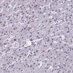 MPP8 Antibody in Immunohistochemistry (IHC)