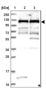 MPP8 Antibody in Western Blot (WB)