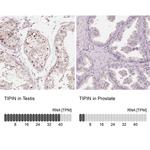 TIPIN Polyclonal Antibody