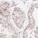 TIPIN Antibody in Immunohistochemistry (IHC)