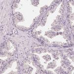 TIPIN Antibody in Immunohistochemistry (IHC)