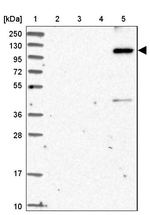 KIAA1468 Antibody in Western Blot (WB)
