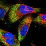 DCP1B Polyclonal Antibody