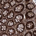 DCP1B Antibody in Immunohistochemistry (Paraffin) (IHC (P))