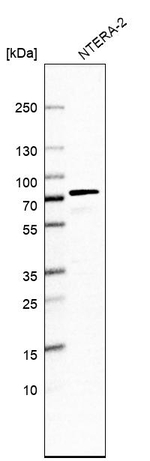 DCP1B Antibody in Western Blot (WB)