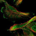 SMAGP Polyclonal Antibody