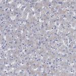 SMAGP Antibody in Immunohistochemistry (Paraffin) (IHC (P))
