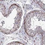 SMAGP Antibody in Immunohistochemistry (Paraffin) (IHC (P))