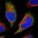 C11orf45 Polyclonal Antibody