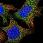 RAB3IL1 Polyclonal Antibody