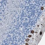 RAB3IL1 Antibody in Immunohistochemistry (Paraffin) (IHC (P))